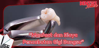 Maybe you would like to learn more about one of these? Manfaat Dan Biaya Pencabutan Gigi Bungsu Dental Universe Indonesia