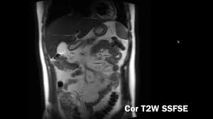 Sep 22, 2020 · using this atlas of human anatomy of the spine and back. Introduction To Ct Abdomen And Pelvis Anatomy And Approach Youtube