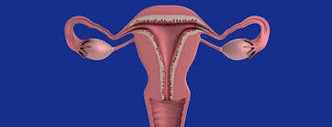 Cancerul mamar isi are originea in tesutul mamar, indeosebi in regiunea ductelor si a lobulilor. Cancer Ovarian Tot Ce Trebuie SÄƒ Stii Cancer360