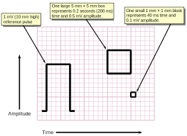 Measuring Time And Voltage With Ecg Graph Paper Medicine