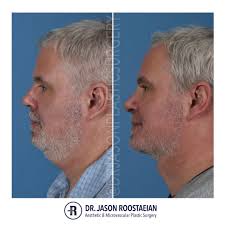 Every item on this page was chosen by a town & country editor. Natural Looking Male Cosmetic Surgery