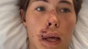 TikToker speaks after falling onto lava rocks: 'Thank you, Jesus'