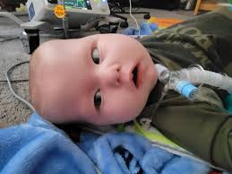 Bingo cancelled due to member's eye surgery