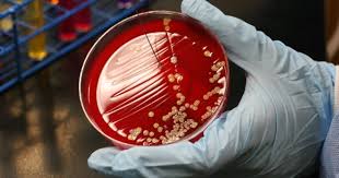 Una delle strategie per prevenire le infezioni da stafilococco è eliminarne le colonizzazioni. Infezione Da Stafilococco Stafilococco Aureo Epidermico Emolitico Saprofitico