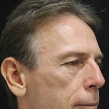 Luis Soro, DO, Dermatologic Surgeon, Board Certified in Dermatology