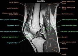It spans from the inferior aspect of the scapula to the proximal part of the humeral shaft. Anterior Cruciate Ligament Injury Knee Mri Cruciate Ligament Ligament Injury