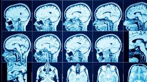 Orang yunani merupakan ahli astronomi terawal yang menyimpulkan bahawa bumi berbentuk sfera dan membuat percubaan untuk mengukur saiznya 2. 6 Perubahan Terhadap Fizikal Seorang Angkasawan Apabila Berada Lama Di Angkasa Lepas Iluminasi