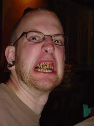 If we don't take care of our teeth and gums, we risk tooth decay, gum disease, and even bone loss. Oh Man Those Look Like The Stereotypical British Teeth Flickr
