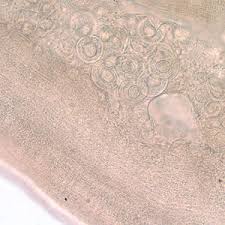 It has many common names including the flea tapeworm, cucumber tapeworm, and. Dipylidium Microscopy Findings
