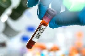 Image result for Hypochloremia