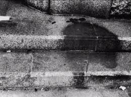 Posts About Louis Malle On Hidden Cause Visible Effects Hiroshima Shadows Hiroshima Victims Hiroshima