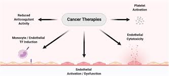 Signs and symptoms of cancer depend on where the cancer is, how big it is, and how much it affects nearby organs or tissues. Cancer Therapy Associated Thrombosis Arteriosclerosis Thrombosis And Vascular Biology