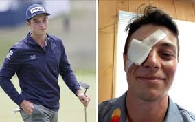 From wikipedia, the free encyclopedia. Viktor Hovland Forced To Withdraw From Us Open With Sand In His Eye After Bunker Shot