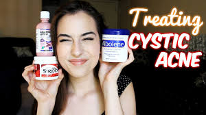 The calamine lotion is a mixture made of the combination of two ingredients: Cystic Acne 3 Affordable Treatments Youtube