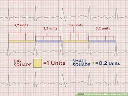 How to calculate heart rate from ecg. How To Calculate Heart Rate From Ecg Arxiusarquitectura