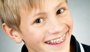 How to help pain after getting braces. Things To Say To Your Kids After They Get Braces Weber Orthodontics