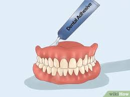 Si la dent est très endommagée, il devient nécessaire de la coiffer d'une couronne afin d'éviter qu'elle ne se fracture. Comment Limer Une Prothese Dentaire 9 Etapes Wikihow