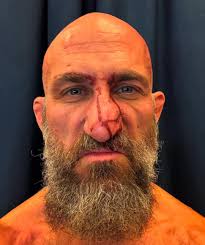 Tommaso Ciampa rocking a Steve Bruce nose after DIY's match against Motor  City Machine Guns at WWE Royal Rumble