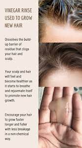 So if you live in a hard water area, your hair looks lank, and your scalp itches all. Pin On Hair