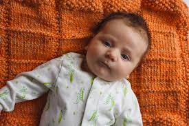 Baby cranial helmet story