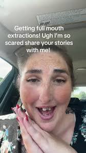 Tooth Extractions Extra Teeth