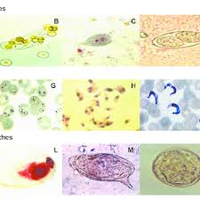 Cryptosporidiosis is an infection that causes diarrhea. Microscopic Images From Clinical Samples A Oocysts Of Download Scientific Diagram