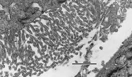 Histologically, three types of malignant pleural mesothelioma (mpm) are classically recognized: Microwave Processing References