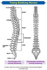 We had long spines, the spines forming the big sail. Menangani Skoliosis Positive Parenting