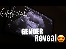 Gender Ultrasound Coupon 11 2021