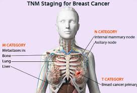 Pain or swelling under the ribs, in the middle or near the right shoulder Understanding Cancer Metastasis Stages Of Cancer And More