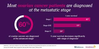Early warning signs of ovarian cancer. Astrazeneca On Twitter Unfortunately Most Ovariancancer Patients Do Not Receive A Diagnosis Until Stage Iv Because Early Symptoms Are Often Overlooked We Are Committed To Supporting Further Research To Help Improve Outcomes
