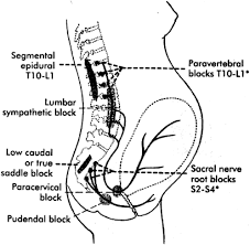 Image result for Paracervical Block