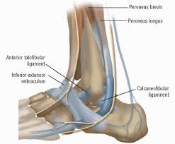 Maybe you would like to learn more about one of these? Anatomic Repair Of Lateral Ankle Instability Musculoskeletal Key