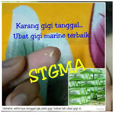 We did not find results for: Karang Gigi Tertanggal