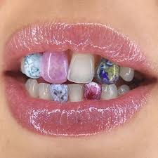 1 202 Curtidas 93 Comentarios Lisa Michalik Lisamchlik No Instagram Marble Grillz For Chloedemoussis Grillz Teeth Jewelry Tooth Gem