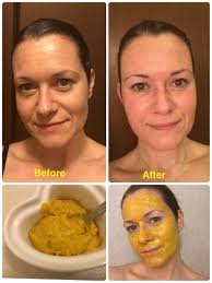I Made A Tumeric And Coconut Oil Mask And The Results Were Insane So Easy Just Mixed Coco Tumeric And Coconut Oil Coconut Oil Mask Health And Beauty Tips i made a tumeric and coconut oil mask