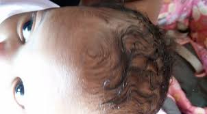 Quando il neonato perde capelli durante i primi mesi di vita, questo non deve allarmare: Caduta Capelli Neonato