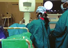 Interventional Radiology Room Equipped With C Arm Fluoroscopy Straight Download Scientific Diagram