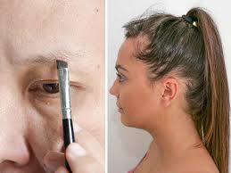 Hair loss is a possible symptom of hypothyroidism or hyperthyroidism. The Fundamentals Of Thyroid Hair Loss Revealed Lewigs