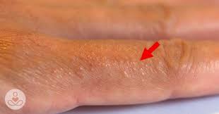 Pin On My Essential Oil Secrets