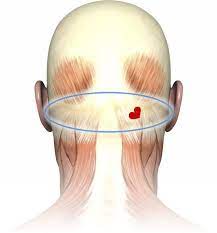 Throbbing Vein Back Of Head Pea Sized Area Please Help Migraine Forums Patient