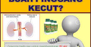 Penyebab sakit pinggang belakang dan cara menghilangkannya. Durian Belanda Khasiat Terhebat Buah Pinggang