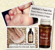 If you don't have healthy feet, neither your body nor your health can truly stand upright. Essential Oil And Athletes Foot Thieves Yleo Fusspilz Young Living Atherische Ole