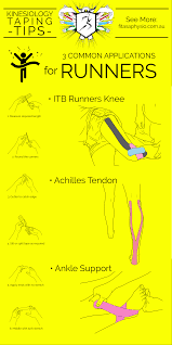 How To Tape For Running Infographic Kinesiology Taping Kinesiology Runners Knee