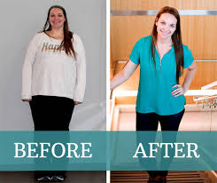 This is what gastric sleeve surgery is like 3 months later this woman lost an extraordinary amount of weight after having 85 per cent of her stomach removed. Gastric Sleeve Surgery Cost Advantages Success Stories Reviews