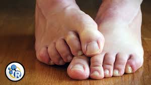 Why Do Feet Smell Youtube