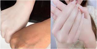 Yg pnting konsisten ye #petuakecantikan @twt_kecantikan pic.twitter.com/5izckwsoxq. Tips Kulit Cerah Kaedah Ini Sangat Berkesan Untuk Memutihkan Kulit Dan Seluruh Badan