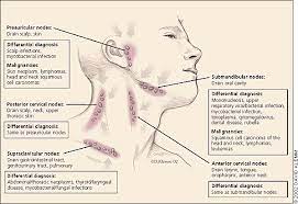 Maybe you would like to learn more about one of these? Lymphadenopathy And Malignancy American Family Physician