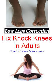 Knock Knees Knock Knees Bow Legged Correction Knee Exercises