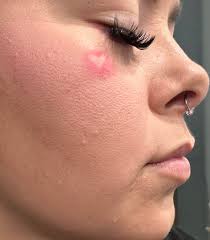 I've perfected a new method of making skin silky smooth again